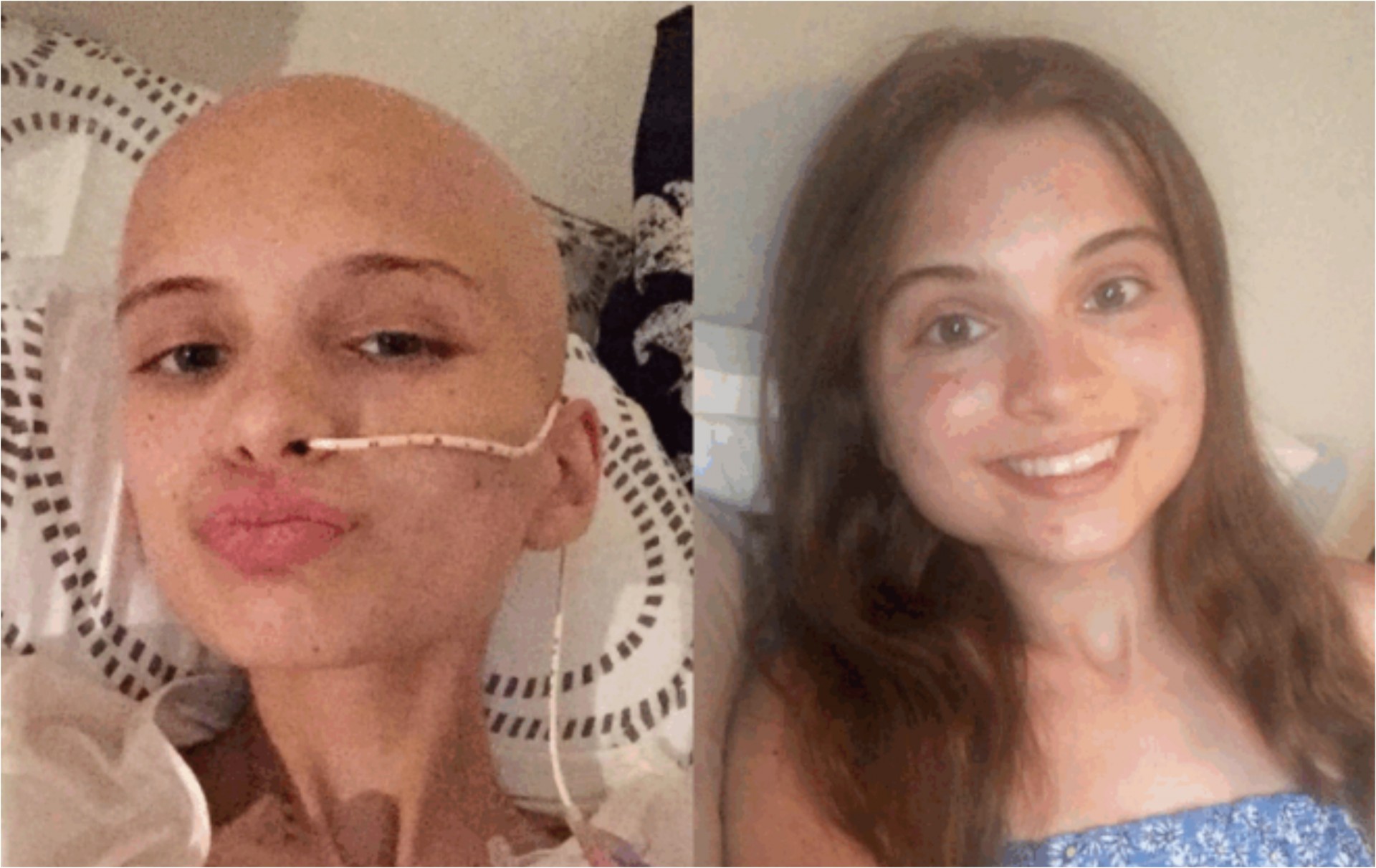 Ги игнорирала овие симптоми со месеци затоа што се срамела: Се испоставило дека има рак