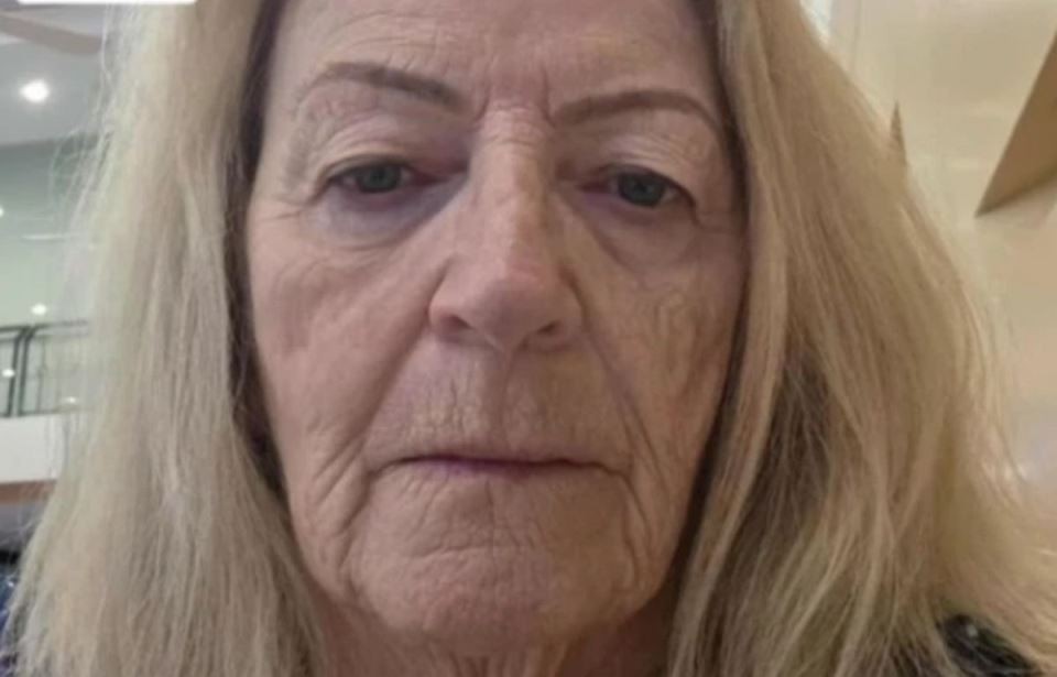 Баба се подмладила на 73 години во Тајланд: Изгледа подобро од нејзината внука по фејслифтинг од 12.000 евра