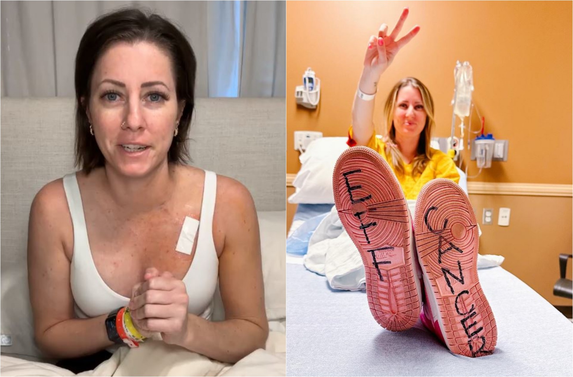 Жена открива неверојатен симптом што се појавил месеци пред дијагнозата - рак на дојка: „Бев целосно скршена“