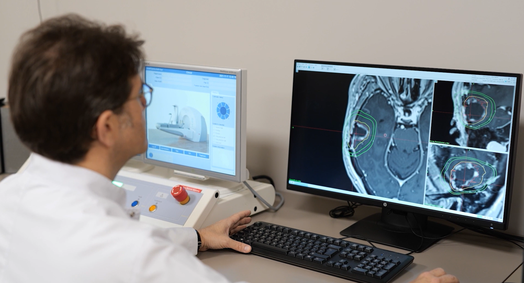 Гама нож: Операција на мозок без ниту еден засек