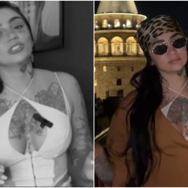 Ана почина во Турција по естетски операции: Пејачката вечерта пред операцијата ја поминала со хирургот