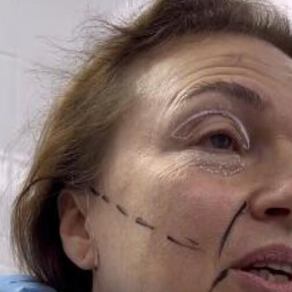 Oтишла на затегнување на лицето, сега ќе мора да менува пасош: Од ординација излегла непрепознатлива - ВИДЕО