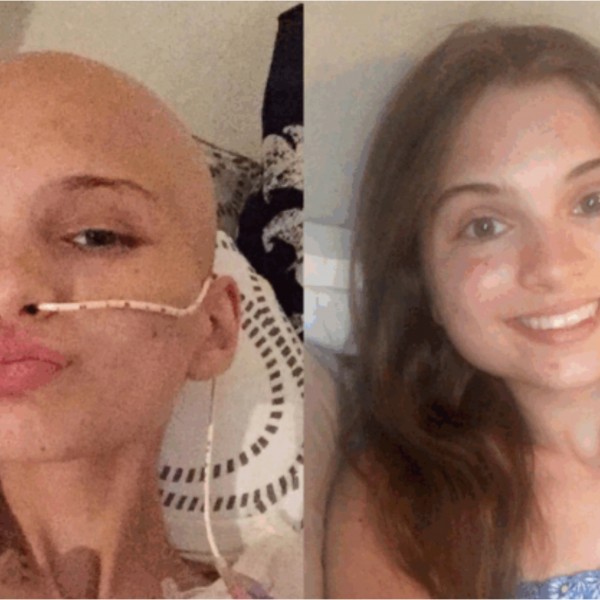 Ги игнорирала овие симптоми со месеци затоа што се срамела: Се испоставило дека има рак