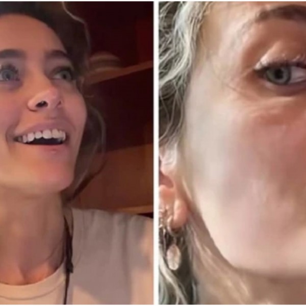 „Носот ми е уништен“: Ќерката на Мајкл Џексон призна дека се дрогирала, па ги покажа страшните последици од порокот ВИДЕО