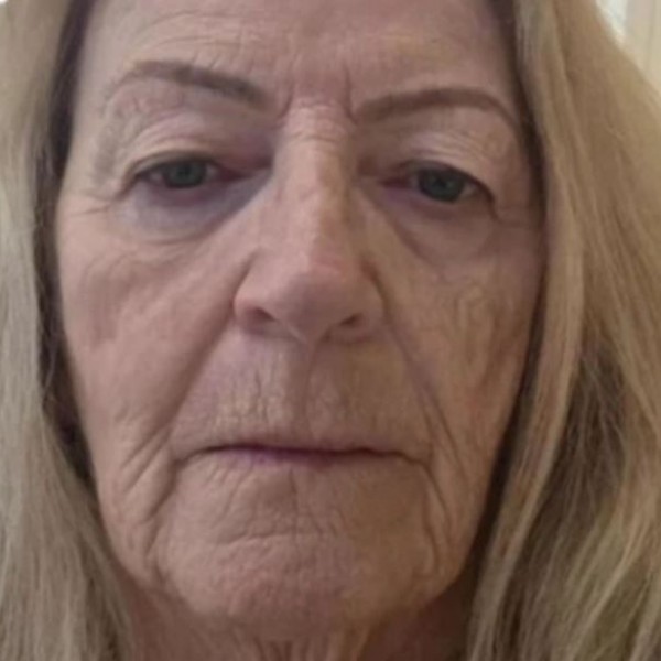 Баба се подмладила на 73 години во Тајланд: Изгледа подобро од нејзината внука по фејслифтинг од 12.000 евра