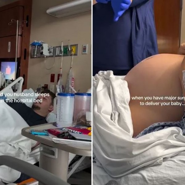 На трудница со месеци ѝ велеле дека носи огромно бебе: А потоа доживеала шок за време на породувањето