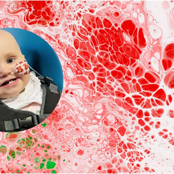 Незамислива трагедија: На бебе со симптоми на настинка му дијагностицирале агресивен рак на крвта