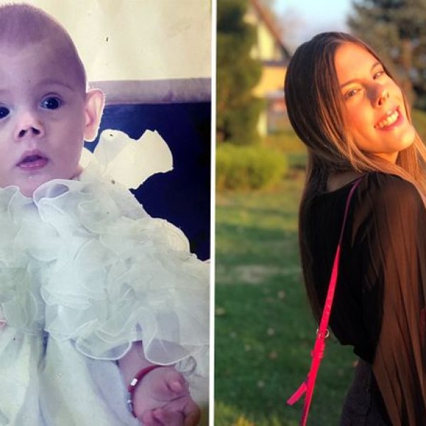 „Се борев и преживеав“: Анастасија е родена со тежина од 520 грама, била исмејувана од врсниците, а денес е храбра и успешна девојка