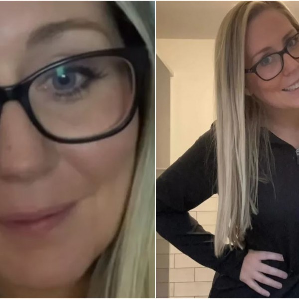 Кожата ѝ пожолтела, како лик од Симпсонови: Ова било симптом на сериозна болест, но го игнорирала